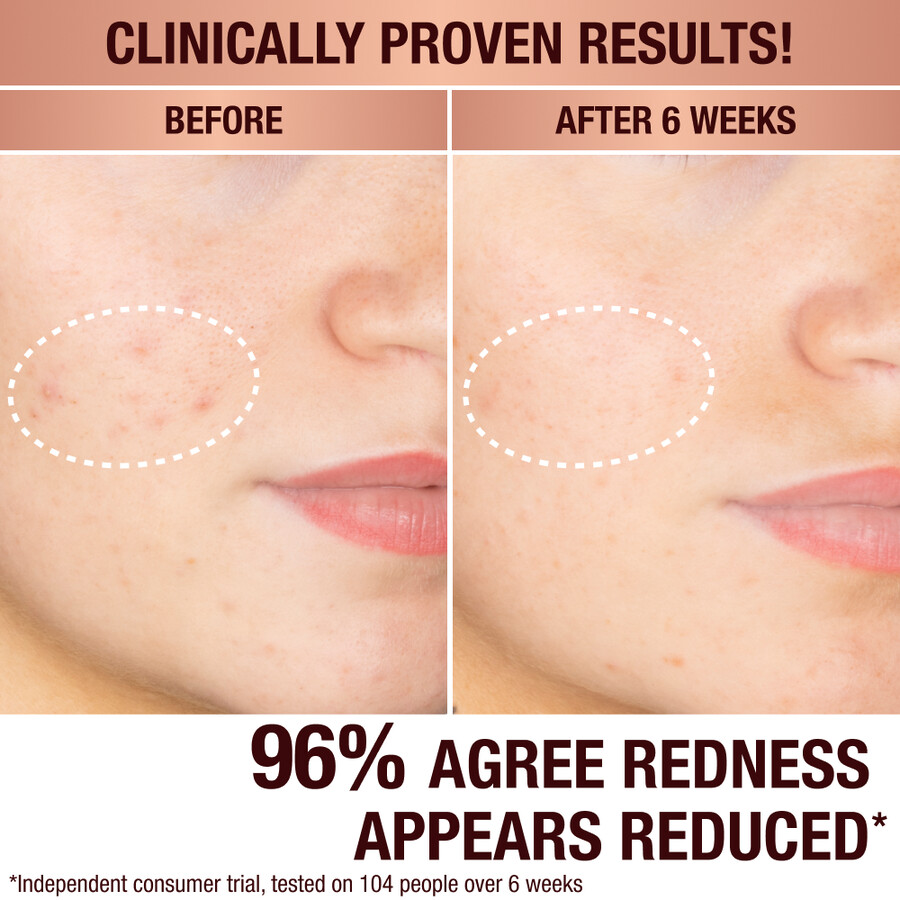 dark spot correcting radiance recovery serum